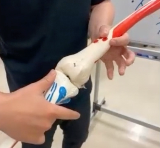 膝関節の触り方