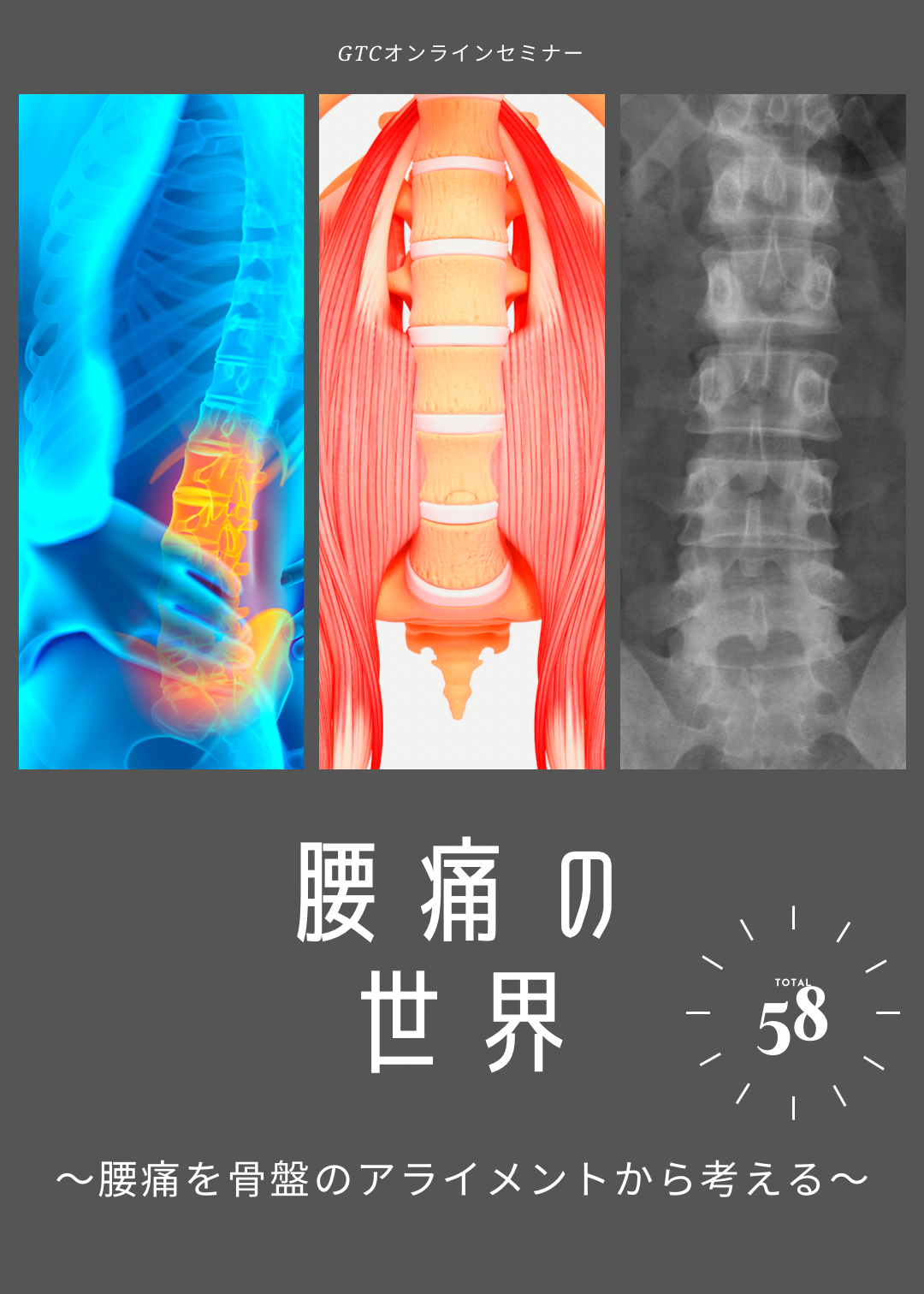 腰痛を骨盤のアライメントから考える