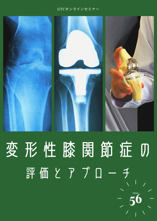 変形性膝関節症の診かた